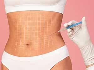 Injection Lipolysis