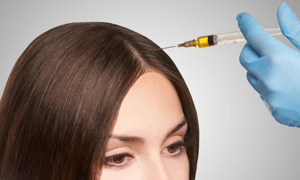 PRP Treatments